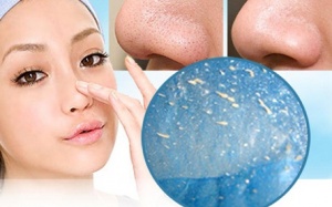 Se khít lỗ chân lông với nguyên liệu nhà bếp