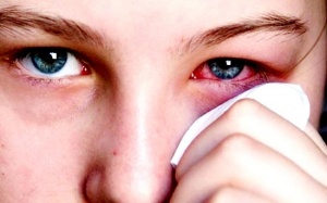 Nắng nóng kéo dài, cẩn thận đau mắt đỏ