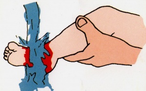 Cách sơ cứu khẩn cấp khi trẻ bị bỏng