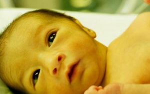 Trẻ sơ sinh bị vàng da có nguy hiểm không?