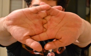 Vì sao không nên bẻ khớp ngón tay?