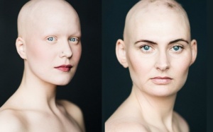 Phụ nữ luôn đẹp, kể cả khi... đầu trọc!