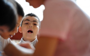 Nhận biết trẻ chậm phát triển tâm thần