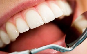 Mất trí nhớ sau khi đi khám răng