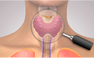 Những bệnh tuyến giáp thường gặp và cách phòng ngừa