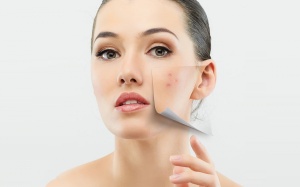 Trị mụn trứng cá ở người trưởng thành 