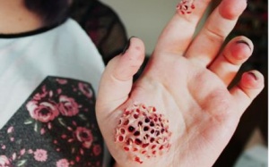 10 chứng bệnh kỳ quặc nhất thế giới