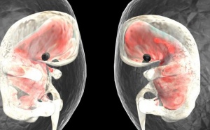 Thai trong thai – hiện tượng kỳ lạ và hiếm gặp