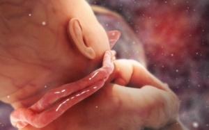 Tràng hoa quấn cổ: Những điều mẹ bầu cần biết!