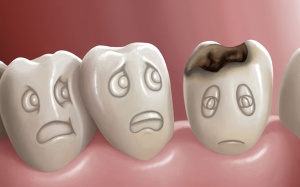 Bị sâu răng đừng vội gặp nha sĩ!