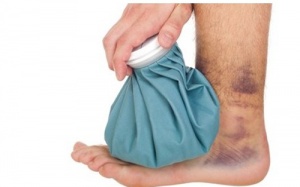 Vết bầm tím bất thường ở người cao tuổi có nguy hiểm không?