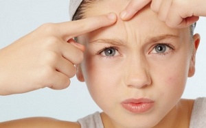 7 mẹo “đánh bay” mụn ở tuổi mới lớn