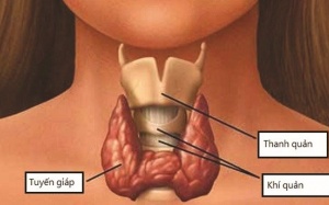 Giải pháp tự nhiên cho bệnh nhân nốt tuyến giáp