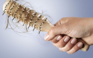 Bệnh tuyến giáp có gây rụng tóc?