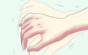 Phân biệt Parkinson và run vô căn