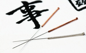 Hiệu quả chữa bệnh Parkinson bằng châm cứu