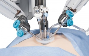 Cắt túi mật nội soi - Phương pháp điều trị dứt điểm sỏi mật