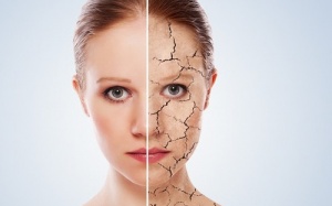 Để da khô không còn là nỗi sợ vào mùa đông