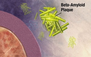 Hòa tan cục protein trị bệnh mất trí nhớ