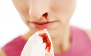 Mất máu trầm trọng vì chảy máu cam kéo dài