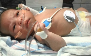 Động kinh ở trẻ sơ sinh không phải lúc nào cũng nguy hiểm