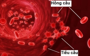 Xét nghiệm máu thấy tiểu cầu giảm nhanh có nghĩa là gì?