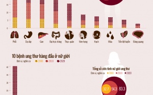 10 bệnh ung thư đang rình rập tấn công người Việt