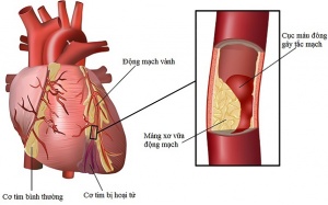 Kiểm tra chức năng mạch máu tại nhà trong 1 phút