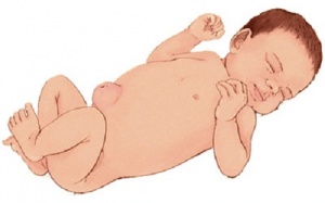 Bé bị thoát vị rốn có nhất thiết phải phẫu thuật không?