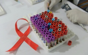 Vaccine HIV mới mang lại hy vọng cho bệnh nhân toàn cầu