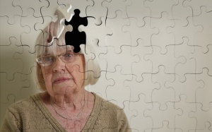 Mắc bệnh Alzheimer có được hiến tạng?
