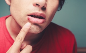 Lở loét miệng nhanh đỡ nhờ thực phẩm và TPCN