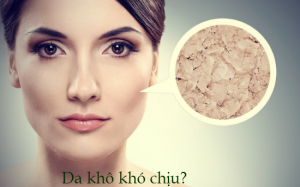 Tự chế mặt nạ - cứu làn da khô mốc