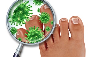 Thực phẩm chức năng nào ngăn ngừa nấm trên cơ thể hiệu quả?