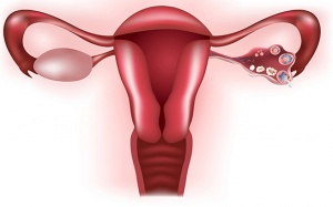 Suy buồng trứng – Bản án vô sinh nhưng vẫn có con được