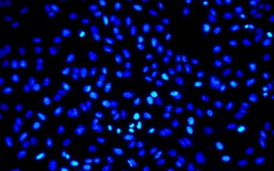 Phương pháp điều trị mới: Đưa chất độc vào thẳng tế bào ung thư