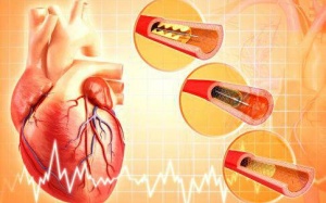 Sau khi đặt stent mạch vành có dùng được Vương Tâm Thống?