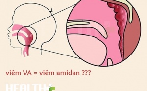 Phân biệt viêm VA và viêm amidan ở trẻ