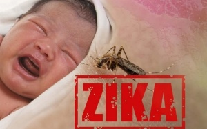 Cả nước đã tiếp nhận hơn 200 mẫu bệnh phẩm nghi ngờ nhiễm virus Zika