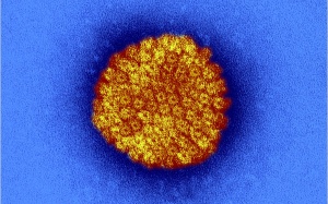 Mụn cóc sinh dục cũng gây... mất trí nhớ?