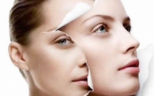 Nhau thai cừu - bí quyết làm đẹp phụ nữ nào cũng muốn giữ cho riêng mình