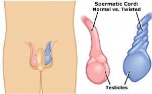 Giờ vàng để cứu… tinh hoàn!