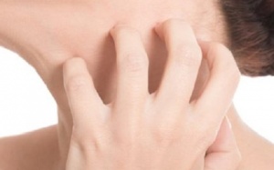 Thường xuyên ngứa ngáy, nổi mề đay phải điều trị như thế nào?