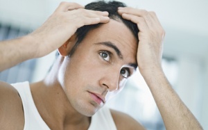 Tập thể hình và nguy cơ hói đầu!