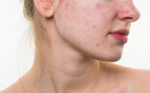 Nhìn da đoán bệnh chuẩn đến giật mình