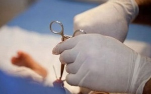 Có nên cắt bao quy đầu cho trẻ mới sinh?