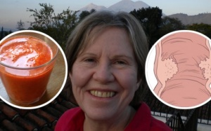 Điều kỳ diệu sau 8 tháng uống nước ép cà rốt của người phụ nữ mắc ung thư