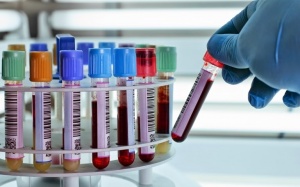 Vì sao phải xét nghiệm Thalassemia (tan máu bẩm sinh)?