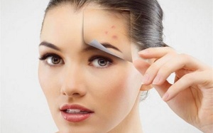 Muốn đánh bay sẹo thâm hãy dùng ngay cách này