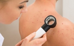 Những điều nên tránh khi bị viêm nang lông